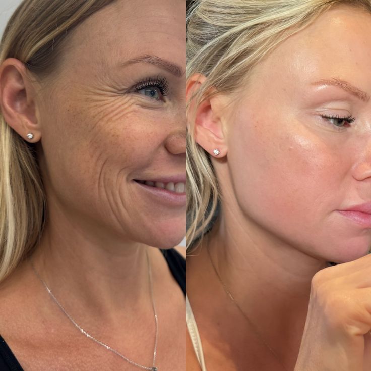 Look 10 Years Younger in Just 4 weeks | NMN & NAD+ Anti Aging Formula