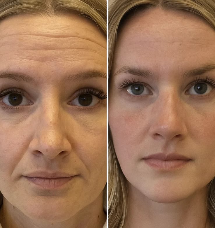 Look 10 Years Younger in Just 4 weeks | NMN & NAD+ Anti Aging Formula