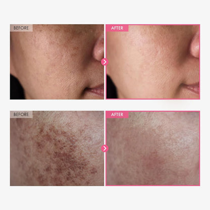 Korean Brightening Cream ™