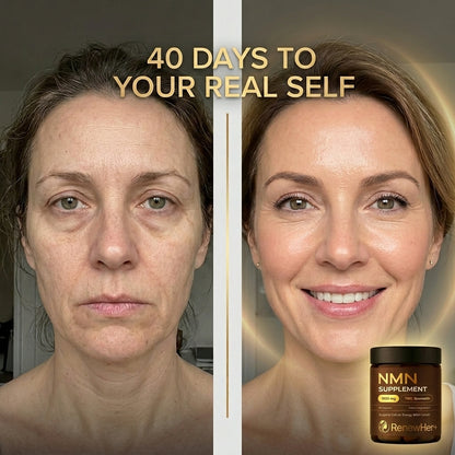 Look 10 Years Younger in Just 4 weeks | NMN & NAD+ Anti Aging Formula